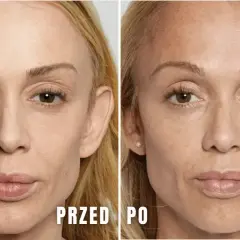 Ile kwasu hialuronowego dziennie? Sprawdź, aby uniknąć błędów