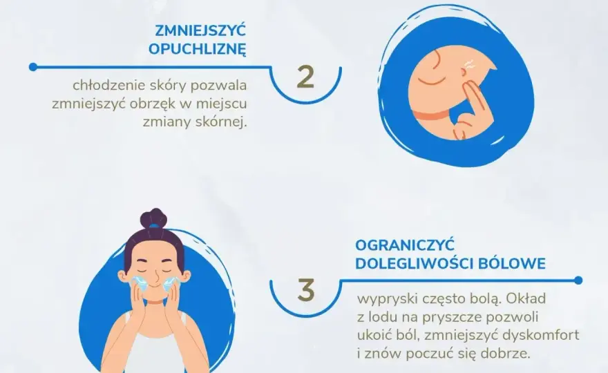 Pryszcz na już? Szybkie sposoby na zmniejszenie widoczności