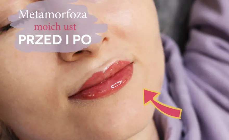Makijaż permanentny ust - czy to boli? Prawda o zabiegu