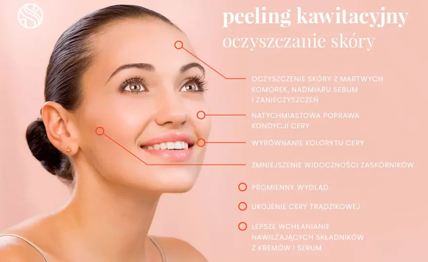 Kawitacja - efekty, cena, dla kogo? Czy warto?