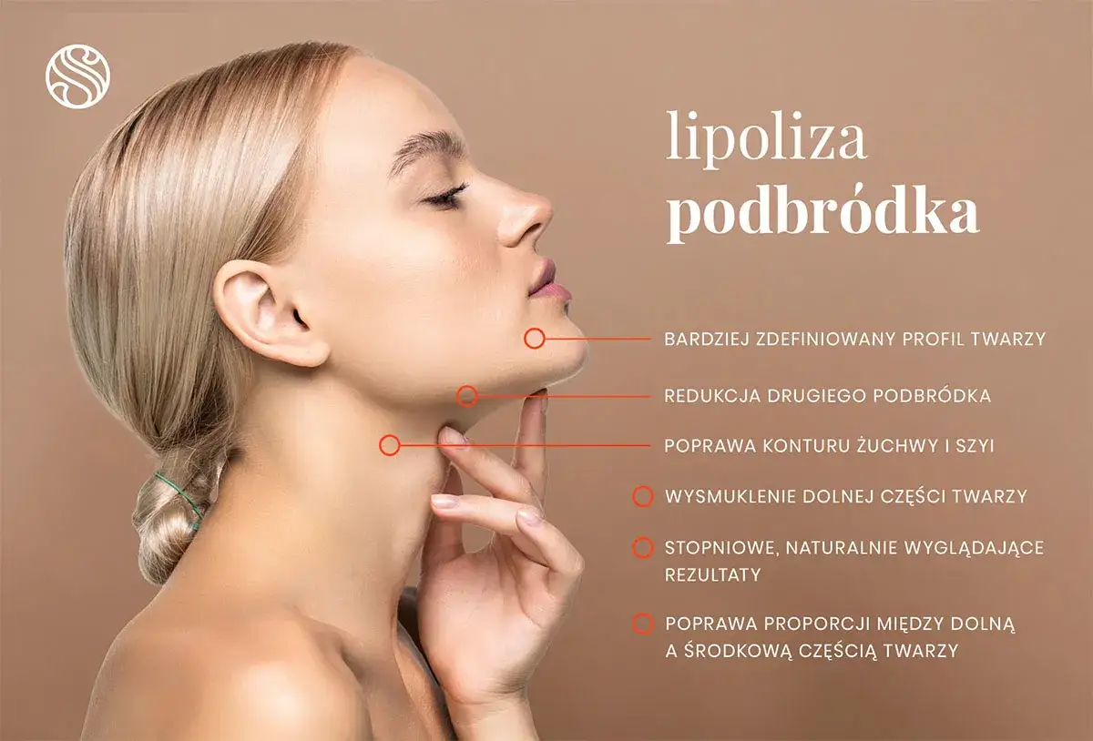 Profil twarzy po lipolizie podbródka: zdefiniowany, smuklejszy, z poprawionymi proporcjami. Sprawdź, jaka jest lipoliza podbródka cena.