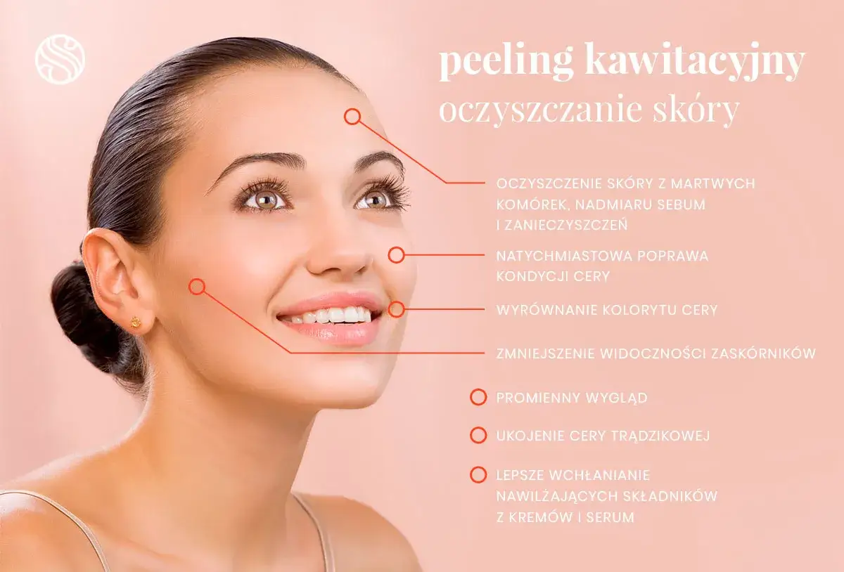 Peeling kawitacyjny efekty: oczyszczenie, poprawa kondycji i kolorytu cery, redukcja zaskórników, promienny wygląd.